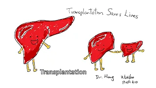 Dr. Hong's Immunology: Transplantation