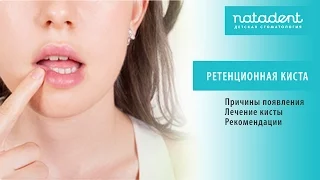 26. Что такое ретенционная киста?  Натадент