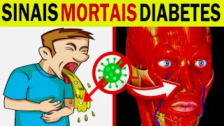 7 SINAIS MORTAIS de DIABETES que Você Não Pode Ignorar (Cetoacidose Diabética)