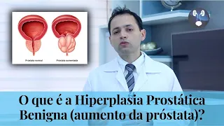 O que é Hiperplasia Benigna da Próstata (aumento da próstata)? - Dr. Hiury Silva Andrade