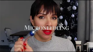 Microneedling: Profondità, Velocità e Cartucce - Rispondo alle vostre domande