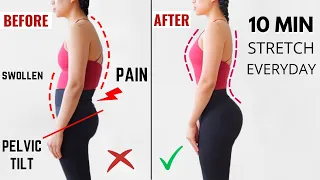 Get beautiful posture in 10 days! anterior pelvic tilt, lower back pain relief, beginner friendly