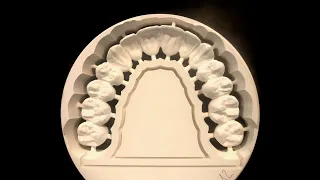 Precisione nella realizzazione di strutture CAD-CAM. Una verifica Sperimentale.