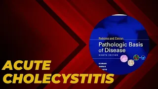 Acute cholecystitis | Pathogenesis | Morphology | Clinical features | Complications | Treatment