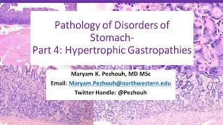 Part 4 - Pathology of Gastric Disorders - hypertrophic gastropathies