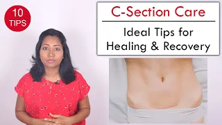 10 Tips to help Heal C Section wound | Post Delivery Care