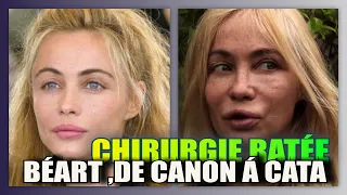 Emmanuelle Béart a gaché sa beauté avec la chirurgie esthétique ratée. Quelle gachis...