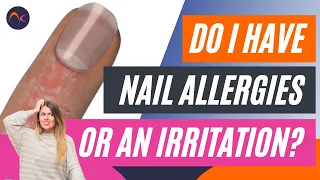 Do I have nail allergies or an irritation? // Understanding an allergen or an irritant is important