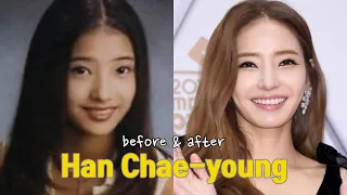 Han Chae-young before and after