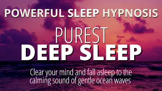 Strong Sleep Hypnosis to Fall Asleep Fast + Positive Affirmations to Reduce Anxiety | Dark Screen