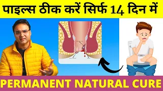 Piles Treatment: पुराने से पुराना पाइल्स (बवासीर) 14  दिन में जड़ से ठीक करें | Piles Home Treatment