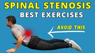 Best Exercises for Spinal Canal Stenosis Pain Relief