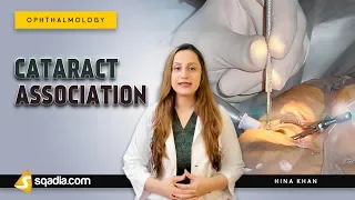Cataract Association | Surgery | Ophthalmology Lectures | Medical Education | V-Learning