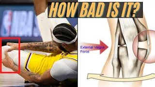 Expert Explains Anthony Davis Injury (Knee MCL Tear) & Return Timeline