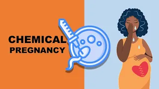 Chemical Pregnancy: Early Miscarriage Due to a Chemical Pregnancy