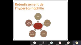 Visioconf - Med interne : Les hyperéosinophilies