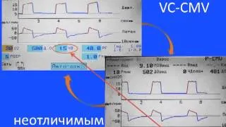 Как настроить аппарат ИВЛ, чтобы VCV не отличалось по своим параметрам от PCV А.С.Горячев