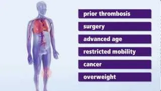 About Thrombosis: Symptoms and risk factors for deep vein thrombosis (DVT)