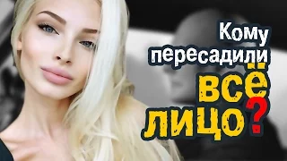 Шишкова призналась, что у неё пересажено всё лицо / Перископ Шишковой 2016 на TopPeriscope.Ru