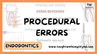 Procedural errors in cleaning and shaping