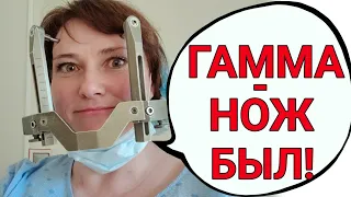 Как все прошло. Первый день после гамма-ножа. Сколько метастазов убрали?