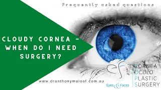 FAQ - Cloudy cornea - When do I need surgery - Dr Anthony Maloof, Sydney