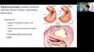 Ch23 Blood Vessels Histology (slides 13-20) - Veins and Cardiovascular Disease