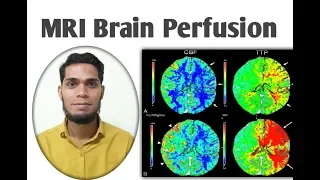 MRI Brain perfusion