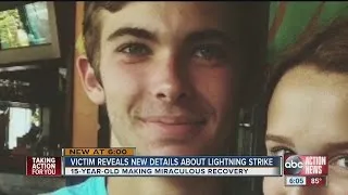 15-year-old lightning victim speaks for first time on surving a direct hit & what really saved him