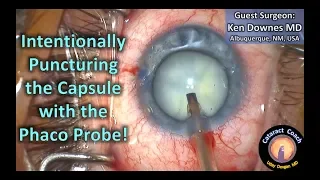 Intentionally puncturing the lens capsule with the phaco probe in cataract surgery