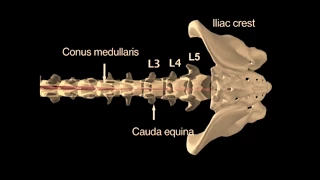 USMLE Question 14 (with answer and explanation) I Lumbar Puncture