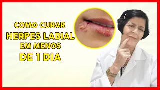 COMO CURAR RÁPIDO O HERPES LABIAL , em MENOS de 1 dia.