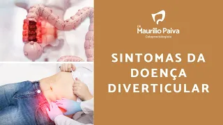 Sintomas da Doença Diverticular