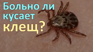 Больно ли кусает клещ и можно ли почувствовать его укус, чтобы сразу его снять?