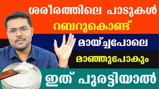 ശരീരത്തിലെ പാടുകൾ ,റബറുകൊണ്ട് മായ്ച്ചപോലെ   മാഞ്ഞുപോകും ഇത് പുരട്ടിയാൽ / Dr Manoj Johnson