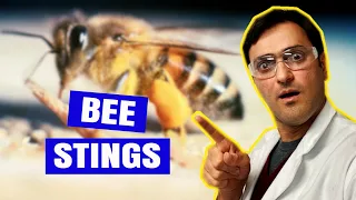 How to Treat BEE STINGS [At Home]