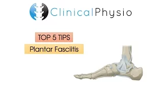 Top 5 Tips: Plantar Fasciitis | Clinical Physio