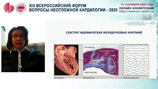 Зал С 12/11/20 14.00-15.30 СИМПОЗИУМ Желудочковые тахиаритмии и внезапная смерть