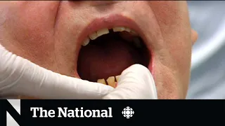 National dental plan to help prevent millions from needing urgent care, doctors say