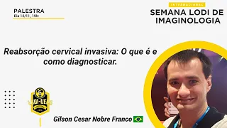 Reabsorção cervical invasiva: O que é e como diagnosticar.