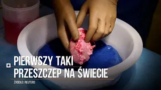 Pierwszy taki przeszczep na świecie. Nerka świni przyjęła się u człowieka