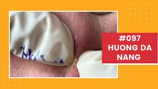 #097 | Huong Da Nang