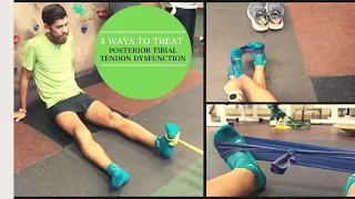 4 Ways to Prevent and Treat Posterior Tibial Tendon Dysfunction