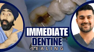 Immediate Dentine Sealing Tutorial Part 1 - PDP173