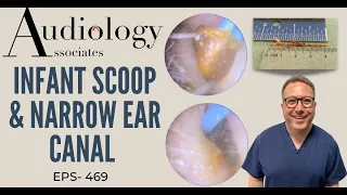 INFANT SCOOP & NARROW EAR CANAL - EP469