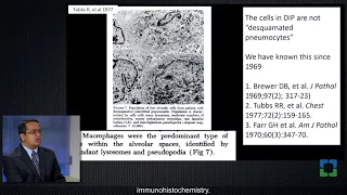 Pathology Insights: Smoking-Related Interstitial Fibrosis with Sanjay Mukhopadhyay, MD