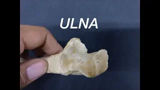 ULNA - GENERAL FEATURES AND ATTACHMENTS