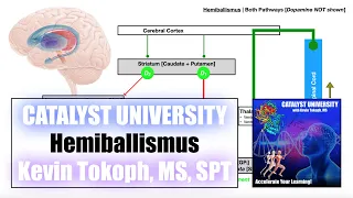 Hemiballismus | Pathogenesis, Signs/Symptoms, and Detailed Mechanism