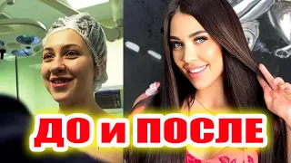 Участницы Дома-2 До и После пластики