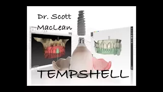 TempShell - Immediate Implant Temporization